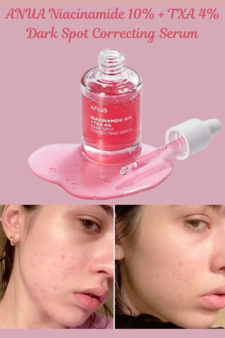 Anua dark spot correcting serum