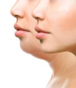 V-Face Lifting Device - Image 4